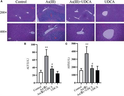 Ursodeoxycholic Acid Protects Against Arsenic Induced Hepatotoxicity by the Nrf2 Signaling Pathway